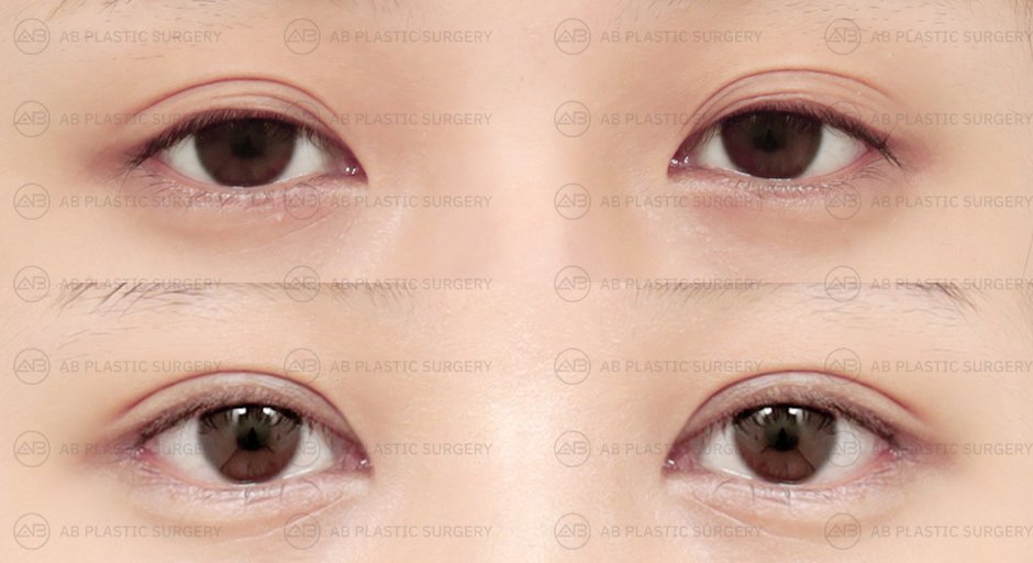 ตาสองชั้น