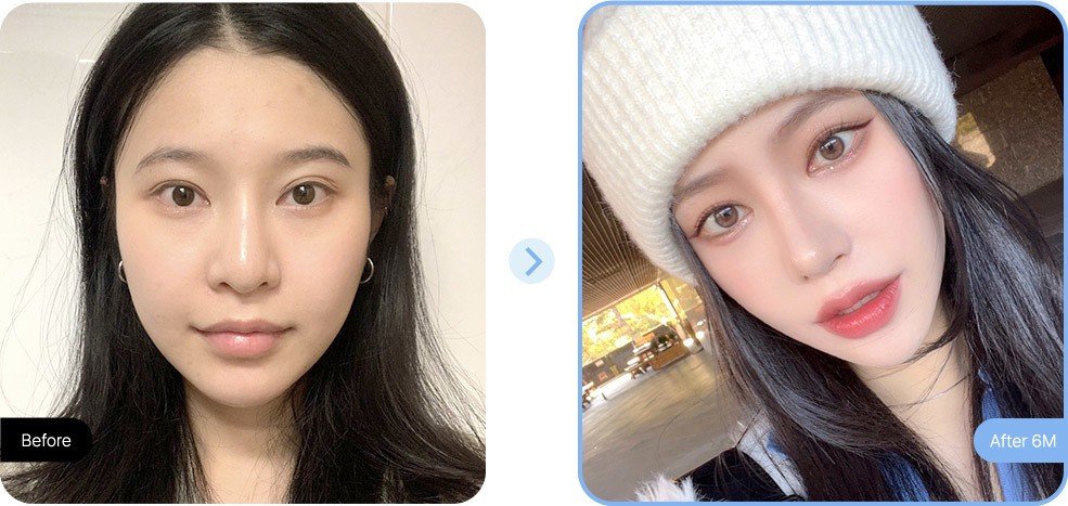 ทำสวยที่เกาหลี โปรโมชั่นสุดพิเศษ